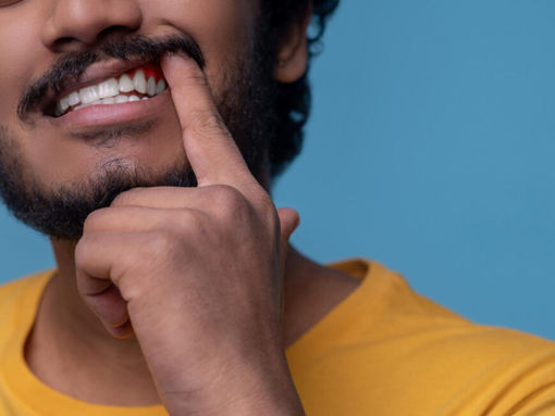 Gum Disease Self-Care