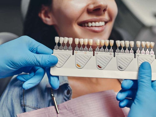 What Are Veneers: History, Benefits, Costs, & How To Choose The Right Dentist