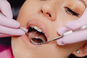 Young Women Undergoing Zoom Teeth Whitening Treatment