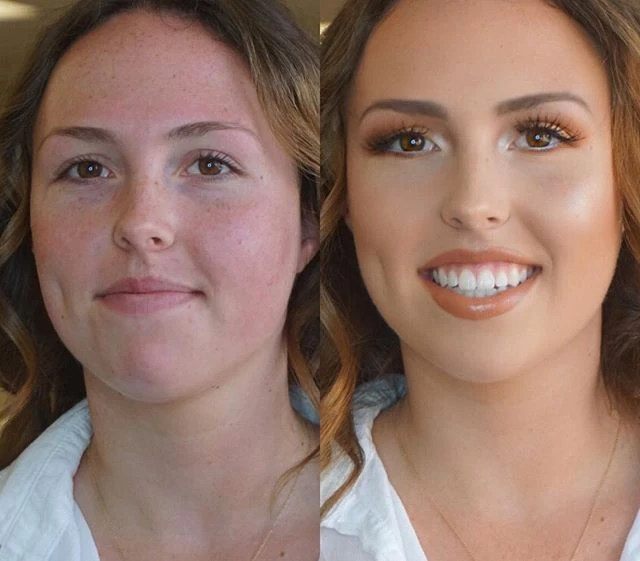Best facial in san diego Amateur free gallery picture