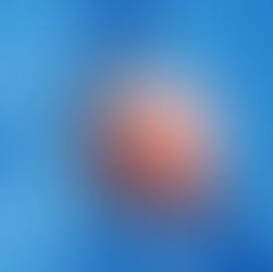 3D medical illustration showing the upper body of a person with highlighted shoulder muscles and tendons, focusing on the deltoid and rotator cuff region against a blue anatomical background.