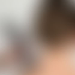 STORZ MEDICAL: Pioneering the Future of Non-Invasive Medicine