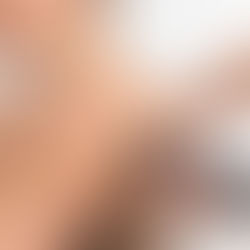 A therapist applying a handheld shockwave therapy device to a female patient's shoulder, with gel on the skin, during a treatment session in a clinical setting.