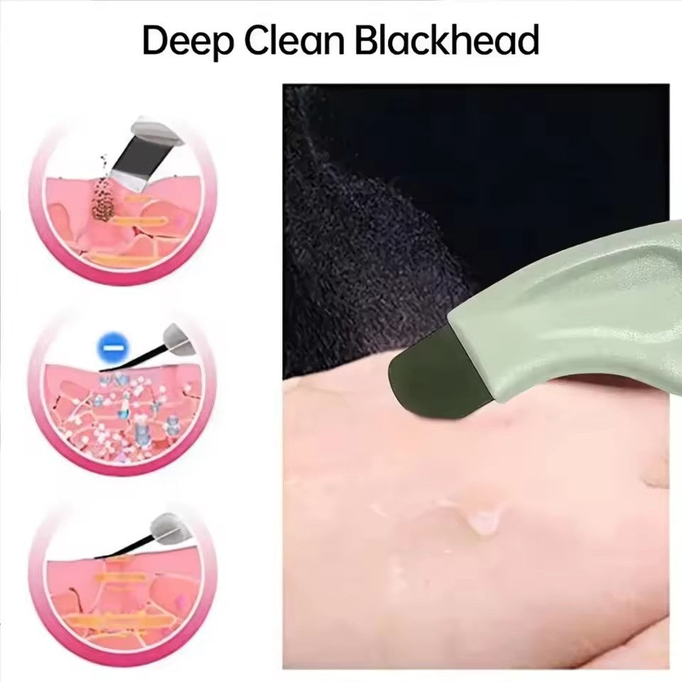 Thumbnail: 1pcs Blackhead and Whitehead Removal Tool for Nose and Face - Skin Pore Cleaner 