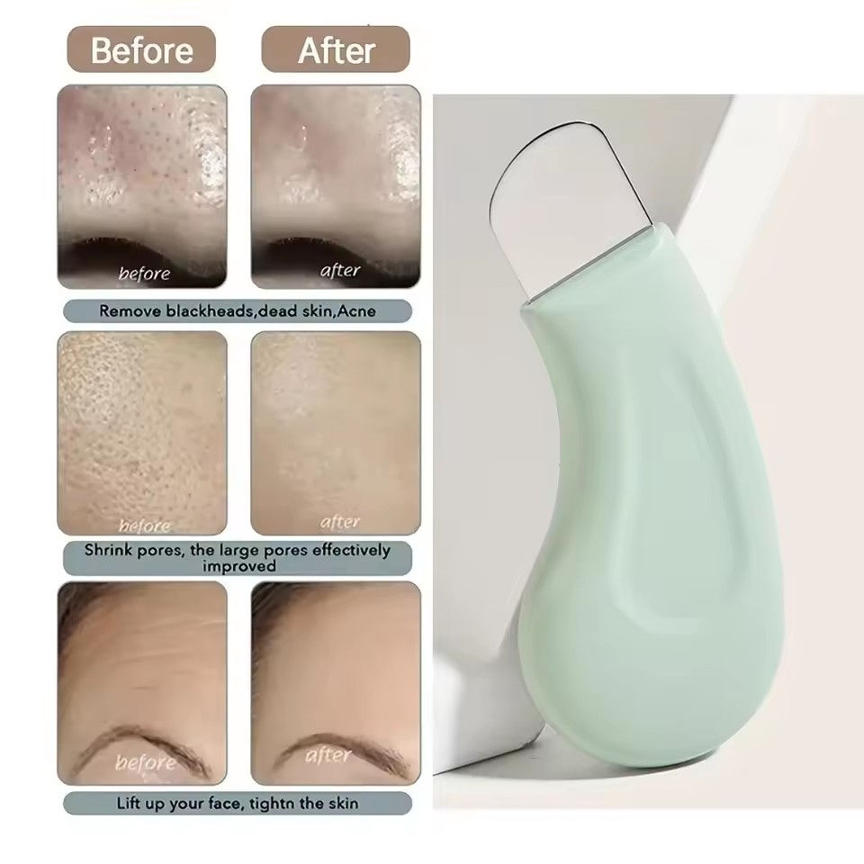 Thumbnail: 1pcs Blackhead and Whitehead Removal Tool for Nose and Face - Skin Pore Cleaner 
