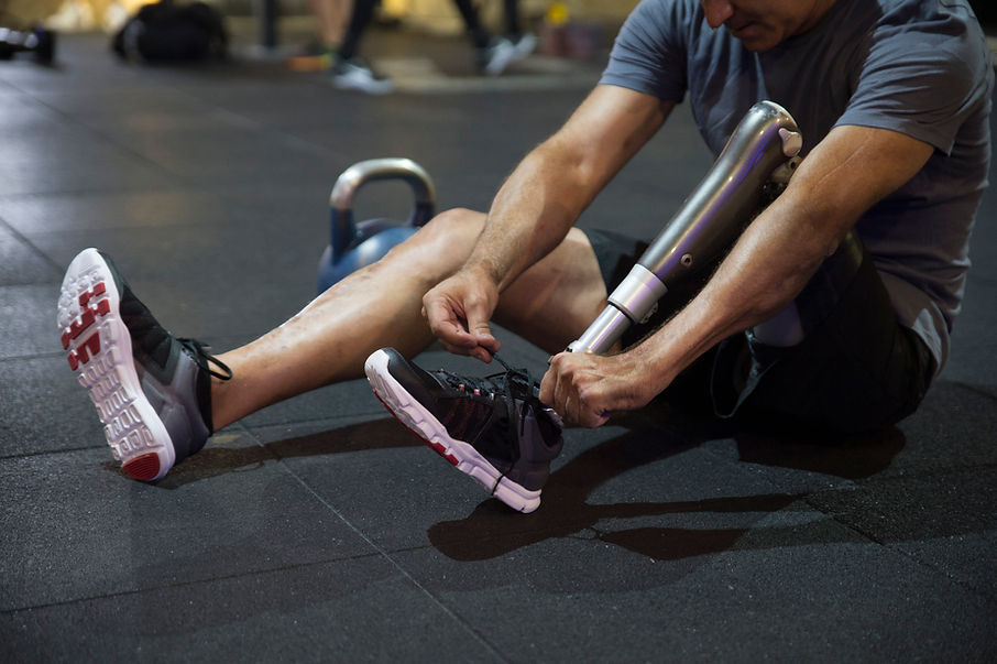 Athlete with Amputated Leg