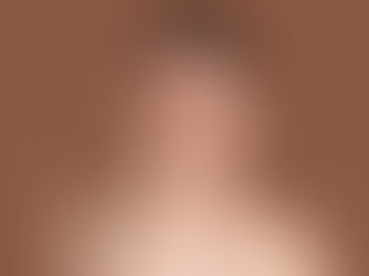 Acne adulta: quando a espinha não vai embora 