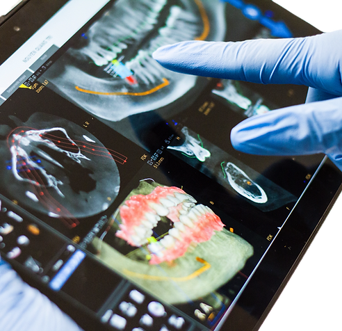 Smart View Pad for Digital Dentist - The New Way To Communicate With The Patient._edited.p