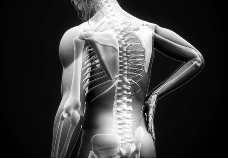 Back pain