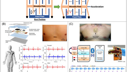 New Publication: Advancements in wearable heart sounds devices for the monitoring of cardiovascular diseases