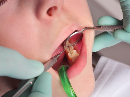 The Anatomy of a Cavity