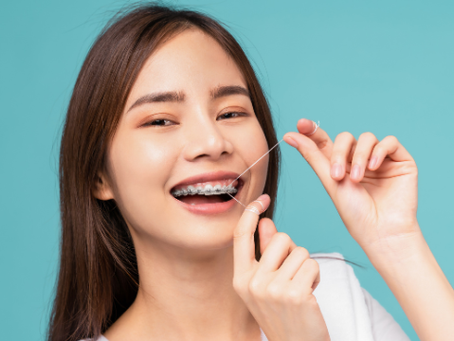 Une bonne hygiène dentaire avec votre appareil