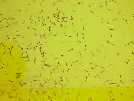 Reporta Salud 32 nuevos contagios por dengue
