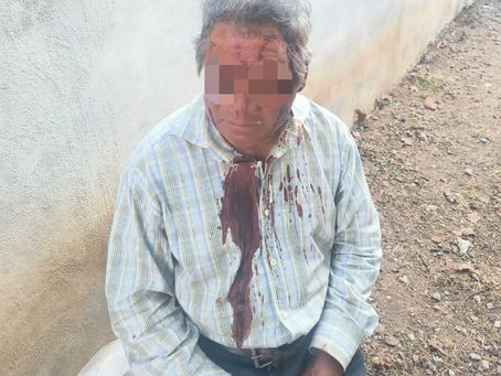 Guarura golpea a ancianito con una arma en Nativitas; familia exige justicia