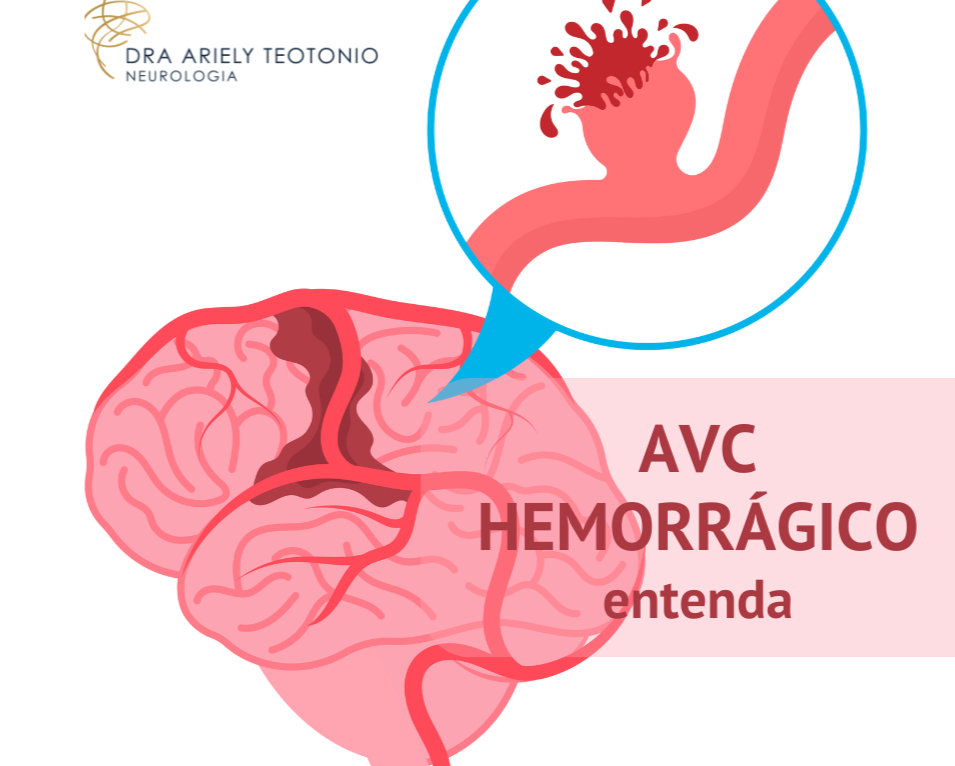 AVC hemorrágico: sintomas, causas e Tratamento