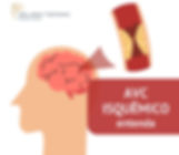 AVC isquêmico- O Que é, Sintomas, Diagnóstico e Como Tratar