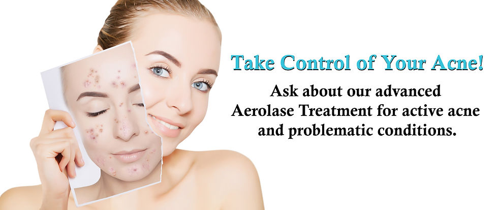 Thumbnail: Aerolase Single Session Laser Facial