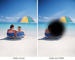 Degeneração Macular: Como Evitar a Perda de Visão na Idade Avançada