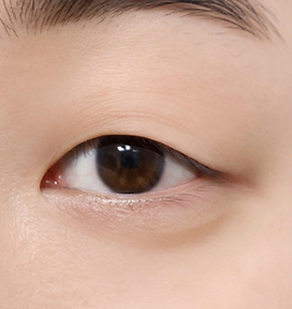 avaé | Premium Korea Medical Tourism Concierge | Australia