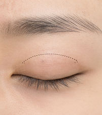 avaé | Premium Korea Medical Tourism Concierge | Australia
