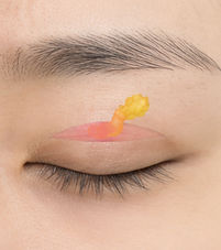 avaé | Premium Korea Medical Tourism Concierge | Australia