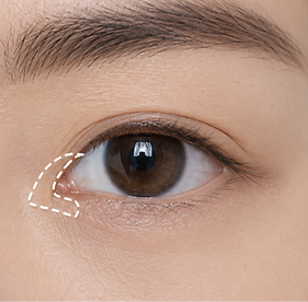 avaé | Premium Korea Medical Tourism Concierge | Australia