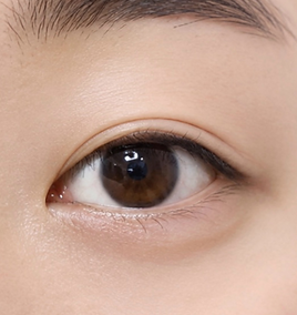 avaé | Premium Korea Medical Tourism Concierge | Australia