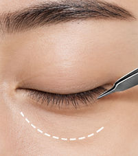 avaé | Premium Korea Medical Tourism Concierge | Australia