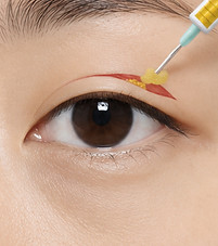 avaé | Premium Korea Medical Tourism Concierge | Australia