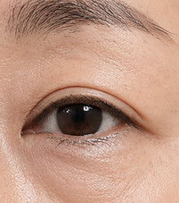 avaé | Premium Korea Medical Tourism Concierge | Australia