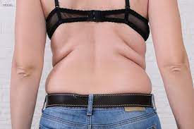 Fat Dissolving - Upper Back