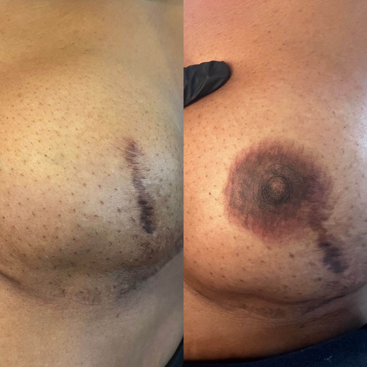 3D Areola & Nipple Tattoo
