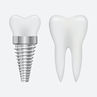 1844397-dente-implante-design-ilustracao