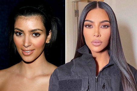 8ml Filler Packages: Advanced Aesthetics or Money Making Sham?
