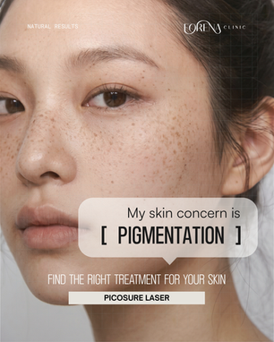 PicoSure for Pigmentation: Sun Spots, Freckles & Acne Marks | Forena Clinic, Seoul