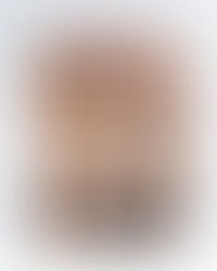 ultherapy prime before and after forena clinic