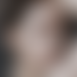 Forena Clinic Biostimulator vs Filler Comparison Table