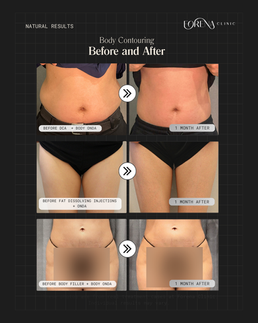 forena clinic body treatments results before and after