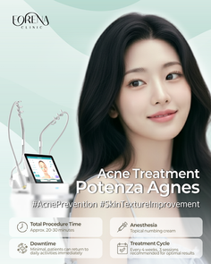 Acne Treatment in Korea: Potenza Agnes Explained