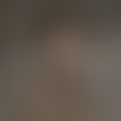 Summer-Safe Skincare Treatments You Can Actually Do | Forena Clinic, Korea