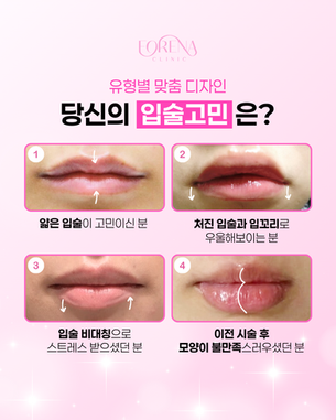 홍대피부과 입술필러, 아직도 용량만 고민하시나요? 