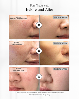 forena clinic before and after