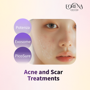 Best Acne & Scar Treatment in Seoul | Forena Clinic