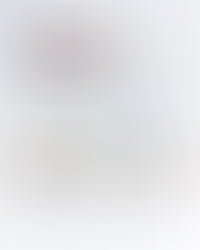 ultherapy prime tips how it works