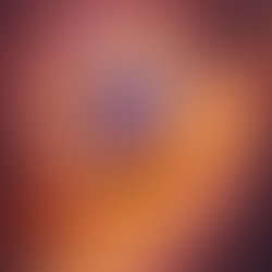 Lipoproteína(a): O que você precisa saber sobre este fator de risco "escondido"