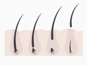 La durée de vie des extensions