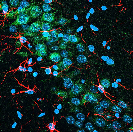 merge 200610 PDAPP47 sorcsx2 green gfap red CA2-Orthogonal Projection-02.jpg