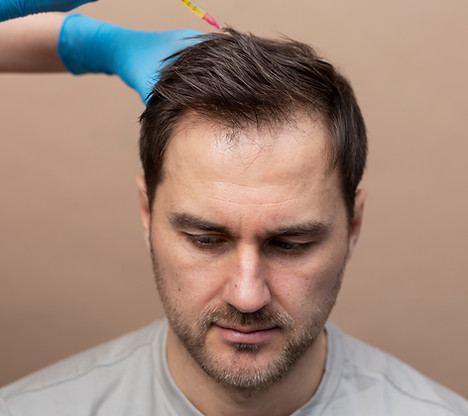 high-angle-man-getting-prp-injection-alopecia.jpg