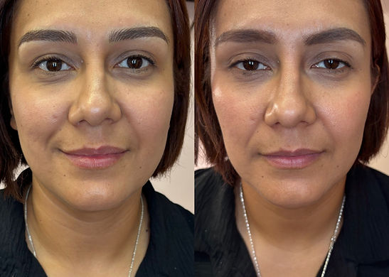 imgi_2_brows-ba.jpg