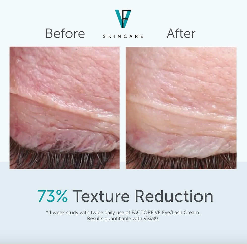 Thumbnail: FACTORFIVE Eye/Lash Cream before and afters – lightweight cream for fine lines, lashes, and brows